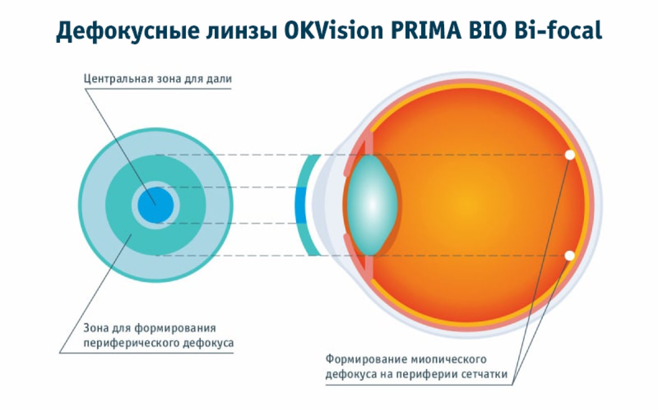 Дефокусные линзы OKVision PRIMA BIO Bi-focal