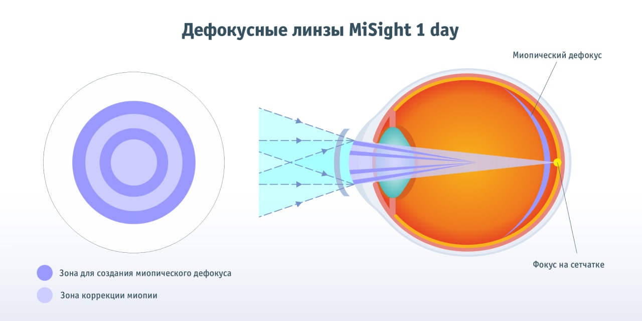 Дефокусные линзы MiSight 1 day