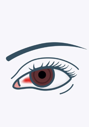 Почему болит глаз при заболевании: причины и симптомы