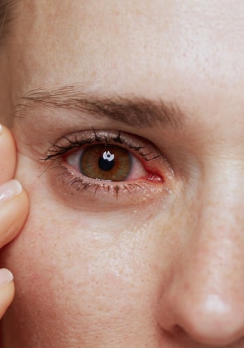 Почему глаза болят после сна: основные причины и способы устранения дискомфорта